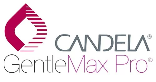 candela laser skin rejuvenation revery medical aesthetics windsor