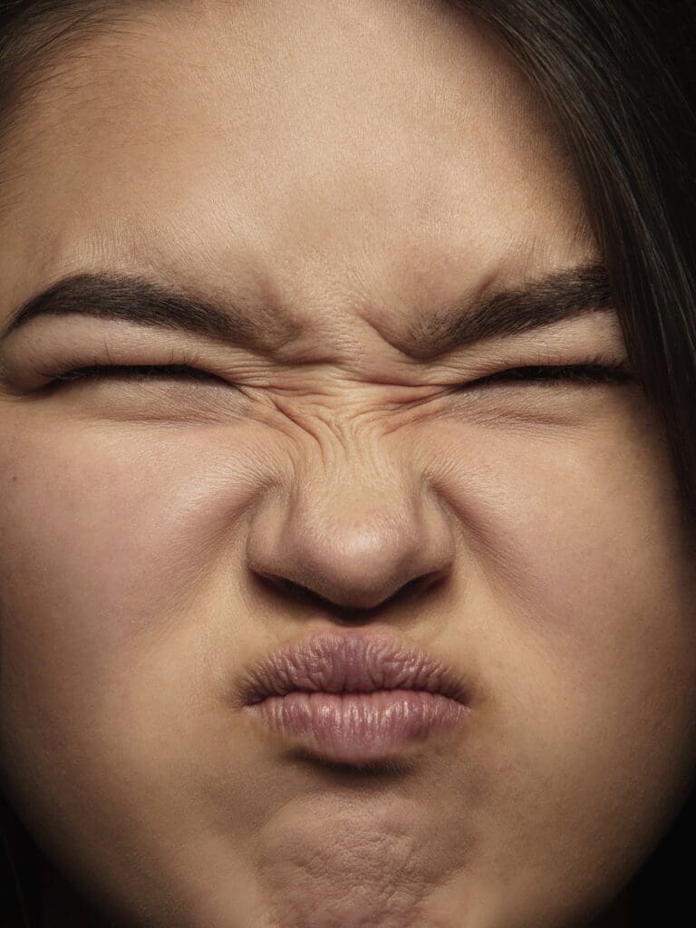 botox wrinkles