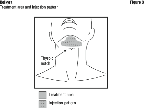 belkyra diagram lasalle revery medical aesthetics