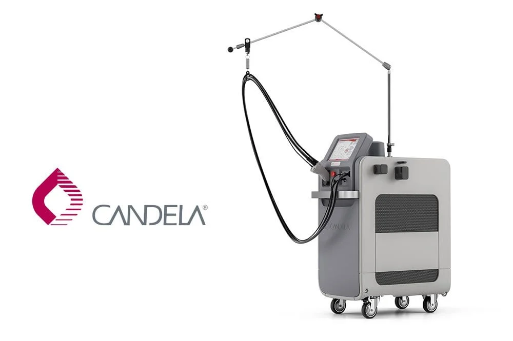 candela laser skin rejuvenation revery medical aesthetics windsor
