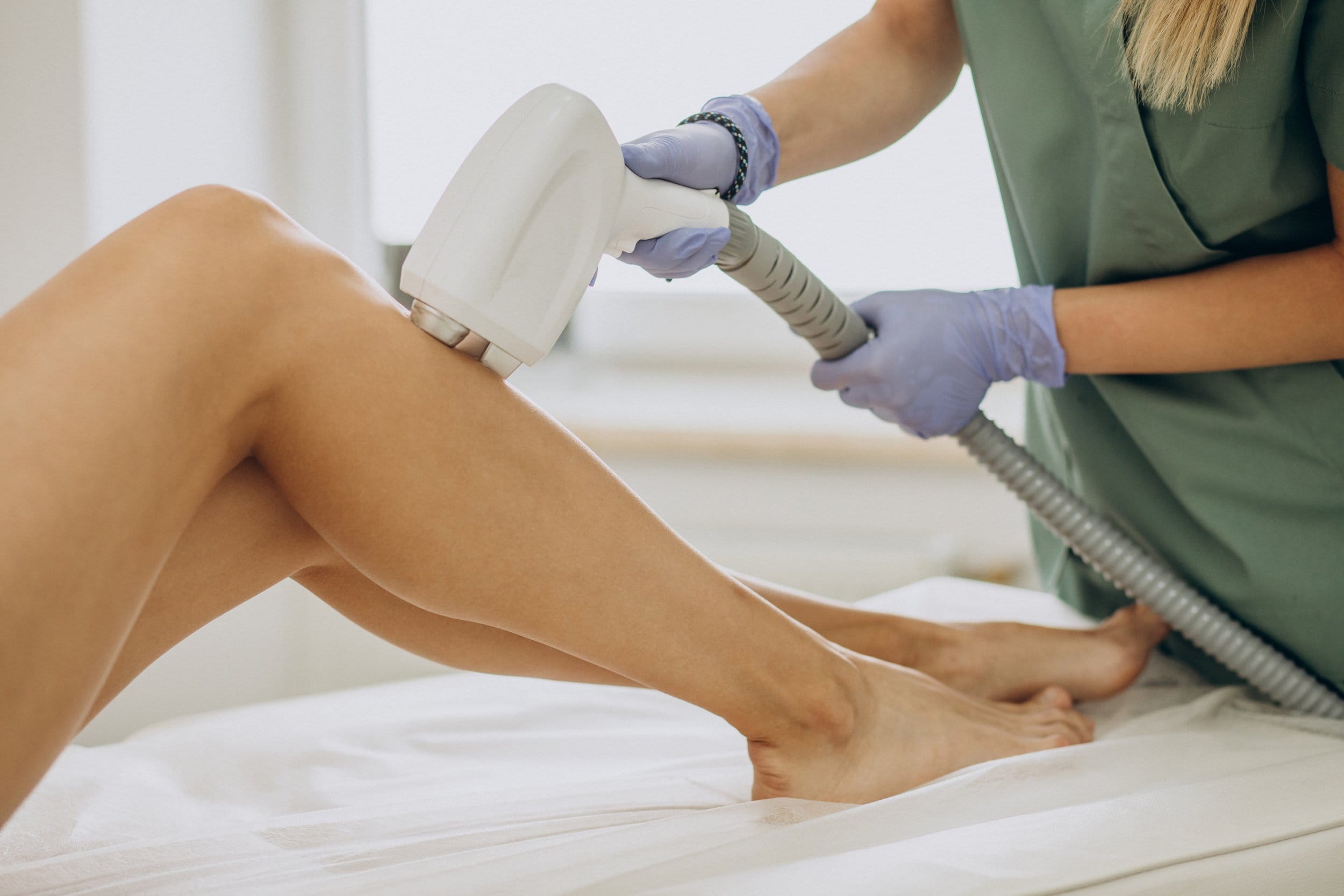 laser hair removal windsor