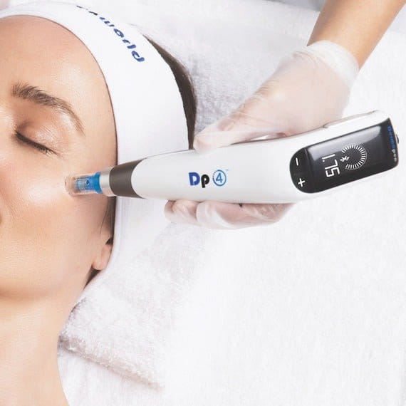 microneedling windsor