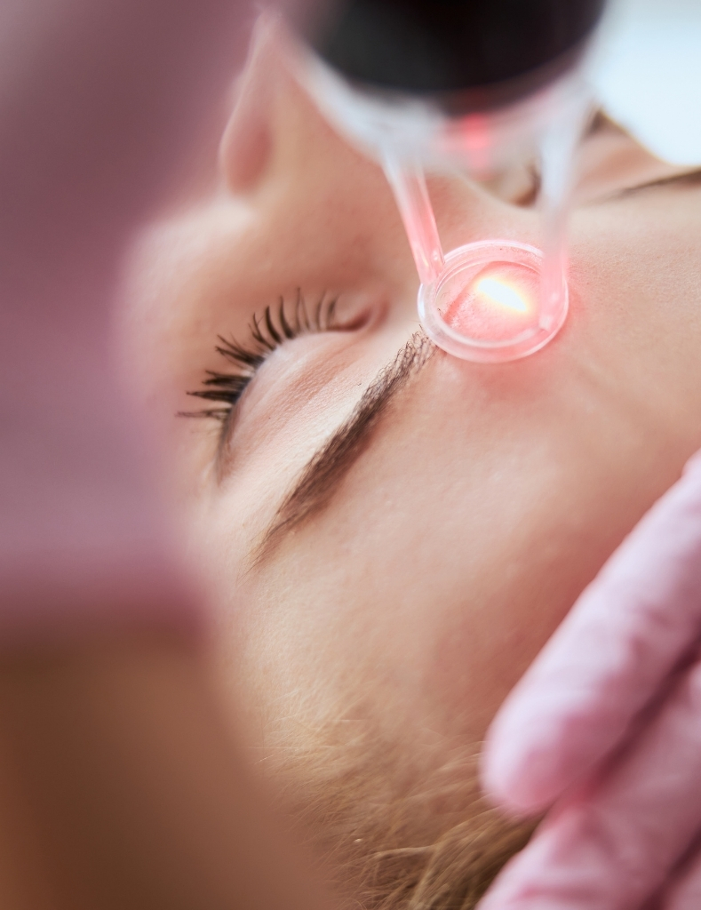 laser-treatment