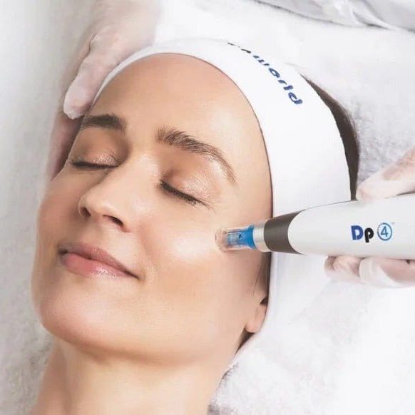 microneedling windsor