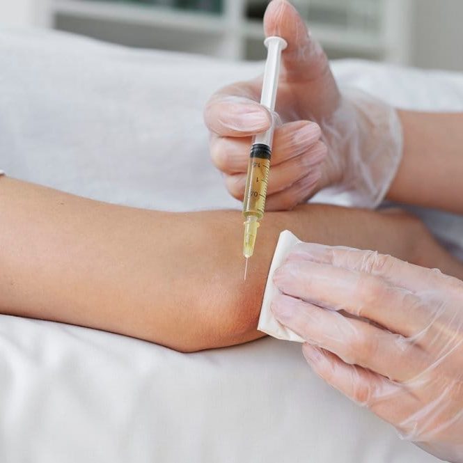 joint injections revery medical aesthetics windsor
