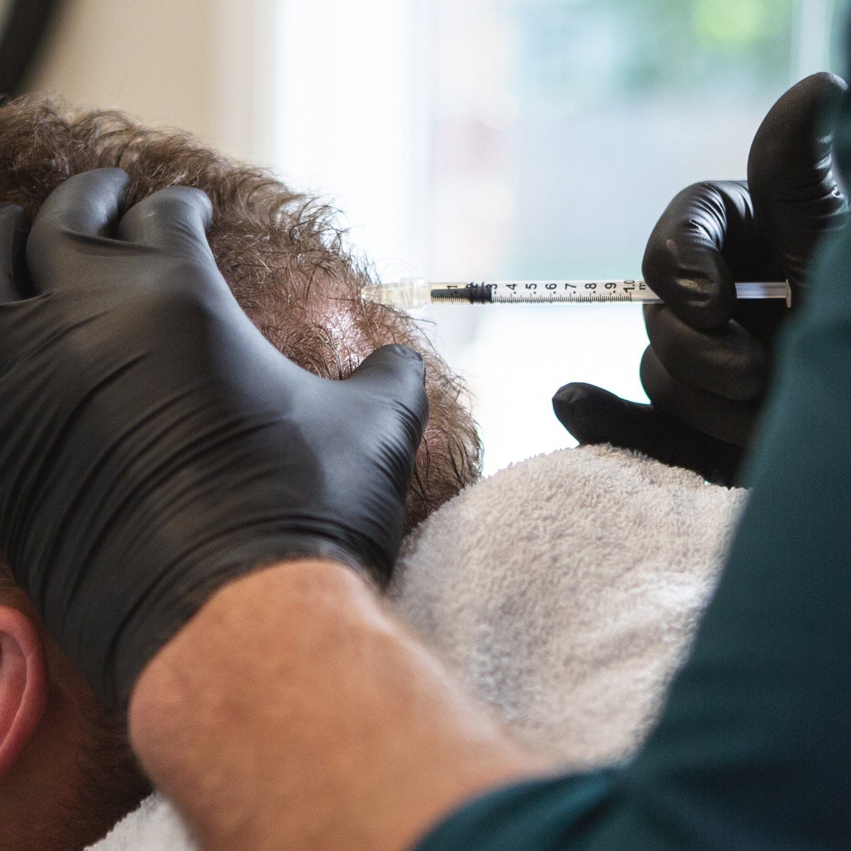 PRP for hair restoration - Revery Medical Aesthetics