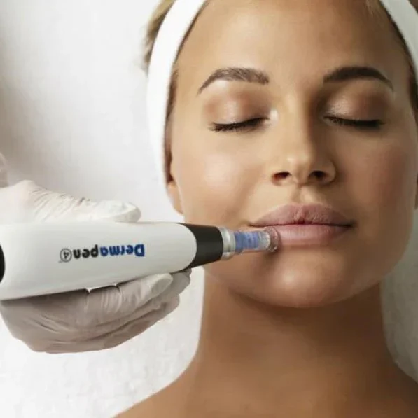 microneedling lasalle revery medical aesthetics