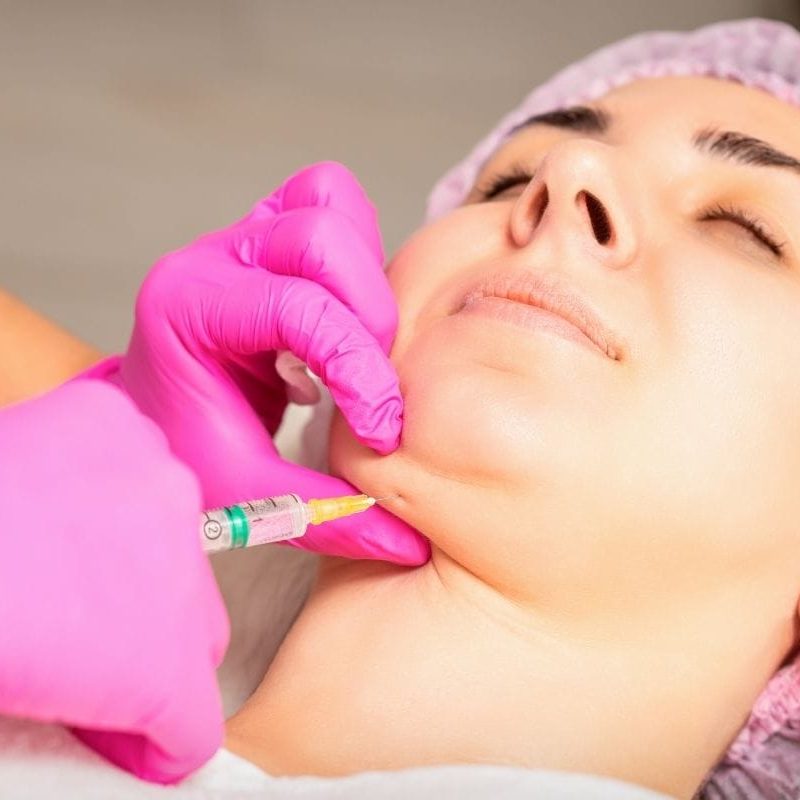 double chin treatment lasalle revery medical aesthetics
