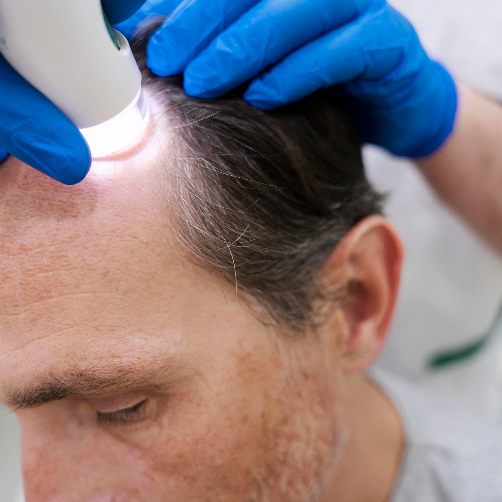 hair restoration in windsor
